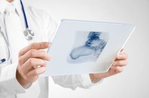 врач держит рентгеновский снимок стопы