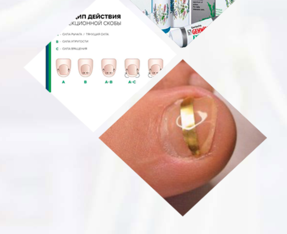 Чем занимается врач-подолог