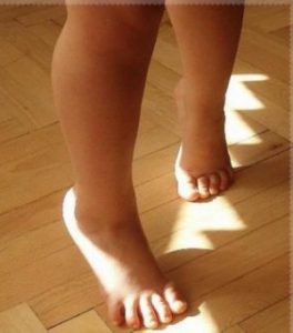ребёнок ходит на носочках