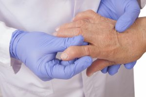 врач смотрит пальцы пациента с артритом